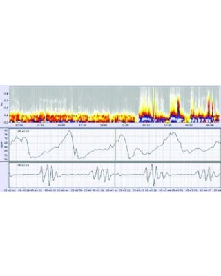 Schiller medilog Holter Floating Network License