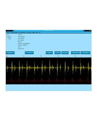 StethView Digital Recording System,717-8000